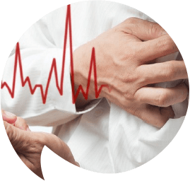 What you should know about myocardial infarction-shape-opt