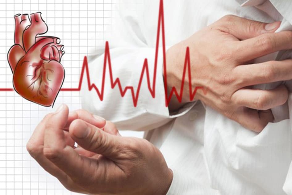 Какво трябва да знаете за миокардния инфаркт